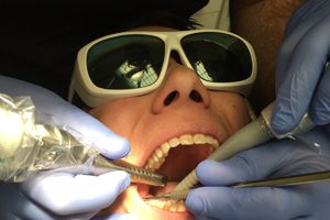Laser Dentistry Treatment
